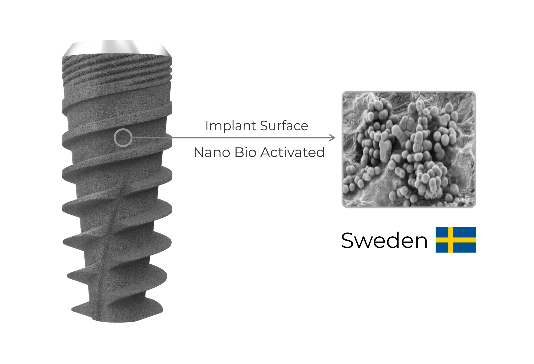 Surface Treatment — i-Fix implant design